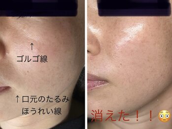 リカルム(Recalme)/40代