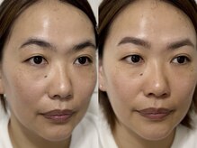 アイブロウスタジオ711./ふんわり垢抜け眉に♪