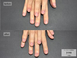ネイルケア　beforeafter