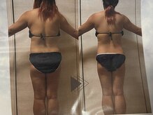 ヨサパーク リアン(YOSA PARK Lien)/モニター様before→after/痩身