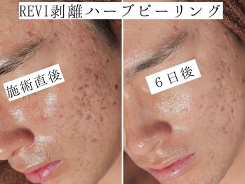 ユウビジン(YOU美人)/