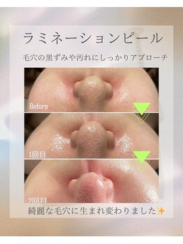 private salon Ponola【ポノーラ】/ラミネーションピール