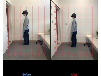 リード整骨院(LEAD整骨院)/姿勢改善、猫背、反り腰