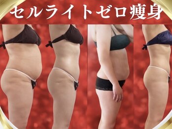 デュモンド(dumonde)の写真/《セルライトゼロでサイズダウン》セル脂肪分解！！ただ痩せるのではなくスッキリ美ボディを目指しましょ！