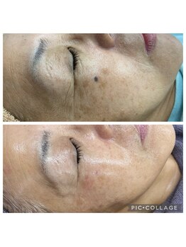 ビラ ベルダ(Bira Beldad)/シミ・シワケア、エイジングケア