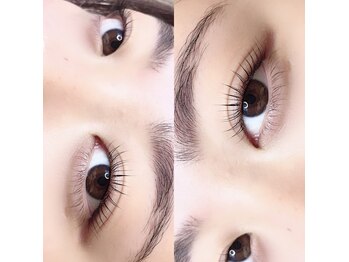 アイバード(eyebird)