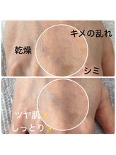 モデラート(moderate)/ハンドエステ