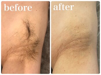 エリクサー 熊谷店(Elixir)/BeforeAfter