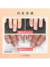 ココネ(cocone)/自爪育成