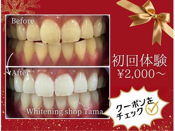 ホワイトニングショップ 多摩店