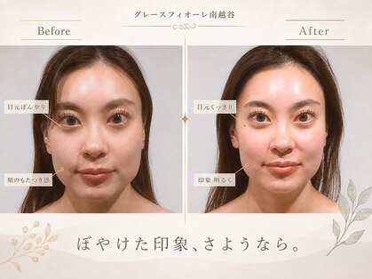 グレースフィオーレ 南越谷店(gracefiore)の写真