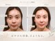 グレースフィオーレ 南越谷店(gracefiore)の写真