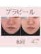 クイーン(QUEEN)の写真/一度で感動！？このツヤ、やみつき♪プラチナピールでうるツヤ水光肌へ