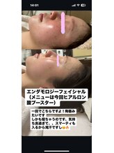 ピーアップ アヤ(P-UP AYA)/