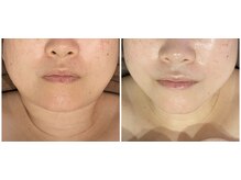 ディアウーマン(Dear Woman)/【骨格小顔矯正】