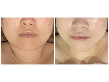 ディアウーマン(Dear Woman)/【骨格小顔矯正】