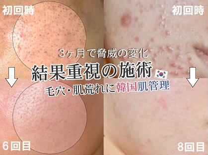 カンナムビューティー 新宿 代々木の写真