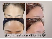 ベラ 東京院(Bella)/何歳になっても、変化は得られる