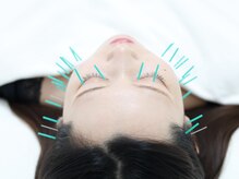 ライフサロン 天神(Life Salon)の雰囲気（小顔・フェイスライン・ほうれい線改善【美容鍼】）