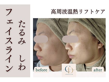 サロンドコーデ(salon de co-de)の写真