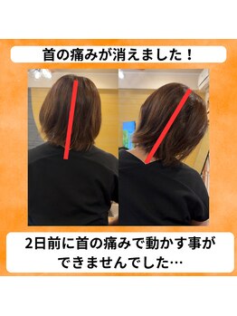 鍼灸整骨院ゼット(Z)/急な首の痛みが改善しました