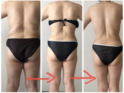 メニー バイ ユリカゴ(Many by Yurikago)の写真