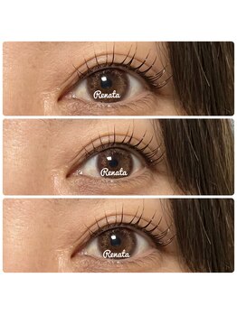 レナータ(Renata)/ラッシュリフト人気デザイン