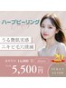 20周年記念★水光艶肌美らハーブピーリング　圧倒的なツヤ肌　5500円　