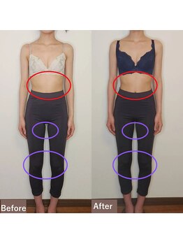 バストラボ 仙台店/【正面3】おなか&脚★