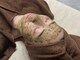ダン(dan)の写真/【毛穴悩みを根本から改善】肌への負担が少ない為、敏感肌の方も施術可能★つるんとした陶器肌へ導きます♪