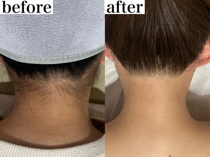 スパ ナナプラス(SPA nana+)の写真