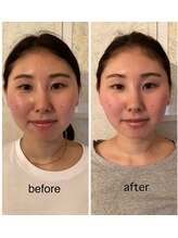 ドクター ヴィーナス/