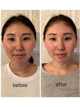 ドクター ヴィーナス/