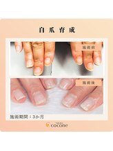 ココネ(cocone)/自爪育成