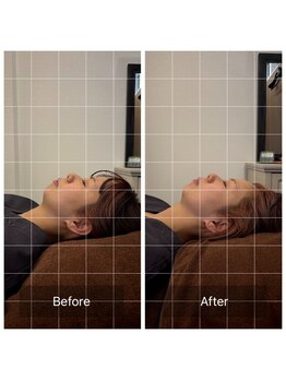 美身庵(Bishinan)/美身庵の小顔整体