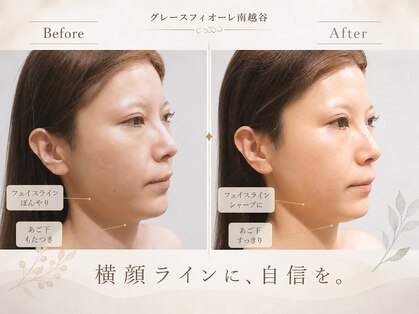 グレースフィオーレ 南越谷店(gracefiore)の写真