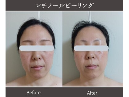 ココロ(COCORO)の写真