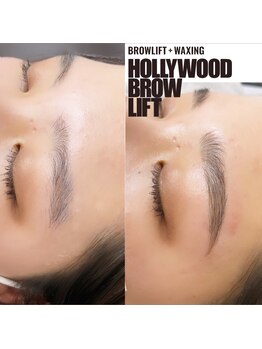 リンクス(links)/ハリウッドブロウリフト