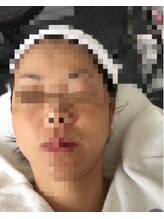 ラ ペジヴル(la Paisible)/【ミラクルリフト】コラーゲン活