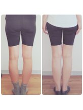 足楽ほんぽ/O脚矯正