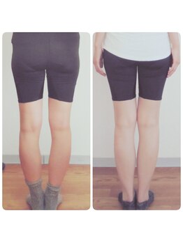 足楽ほんぽ/O脚矯正