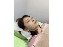 アポロ鍼灸マッサージ接骨院
