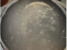 ミュー 刈谷店(mieux)の雰囲気（超音波毛穴洗浄でこんなにもごっそり汚れが取れます！！）