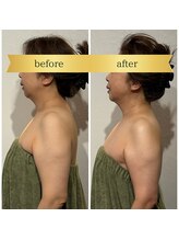 イトヒコ/ビフォーアフター