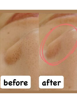 サロン ド プリヴェ(Salon de PRIVE)/抗酸化対策で肌老化をストップ