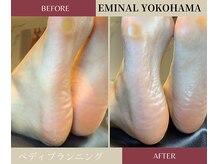 エミナル 横浜(EMINAL)/