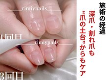 リミーネイルズ(rimiynails)の雰囲気（rimiy式!根本改善したい方！お爪が別人の様に変化◎解消できます）