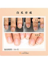 ココネ(cocone)/自爪育成