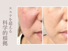 ラウン 京都(ROUN')/40代からの本気のエイジングケア