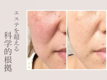 ラウン 京都(ROUN')/40代からの本気のエイジングケア